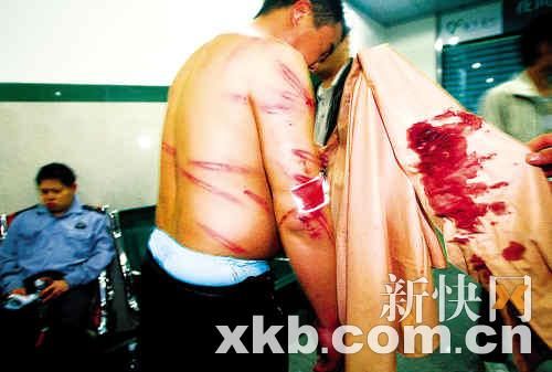 多名小区保安被打伤。